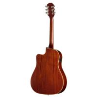 Epiphone J-45 Standard EC Elektro Akustik Gitar (Honey Burst)