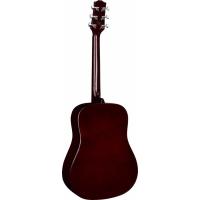 SX SA1 SK NA Dreadnought Akustik Gitar Seti